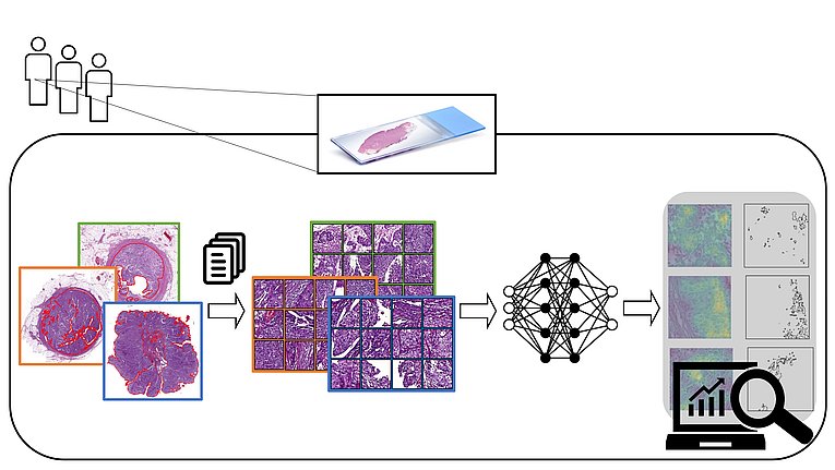 Deep learning-based subtype prediction in urothelial cancers (Copyright: Miriam Angeloni, Fulvia Ferrazzi